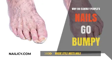 Why Elderly Nails Become Bumpy: Causes and Care Explained