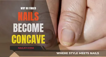 Unraveling the Mystery: Why Do Finger Nails Become Concave?