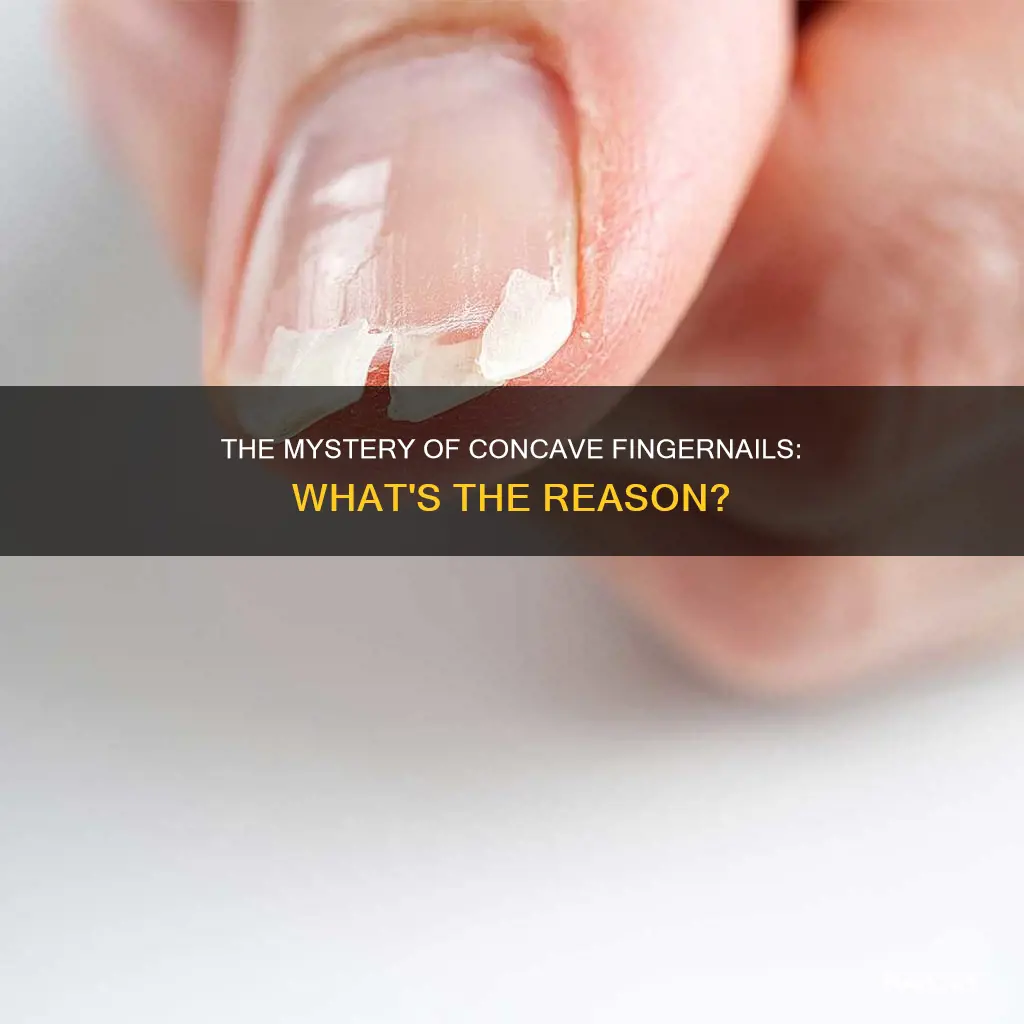 why do finger nails become concave