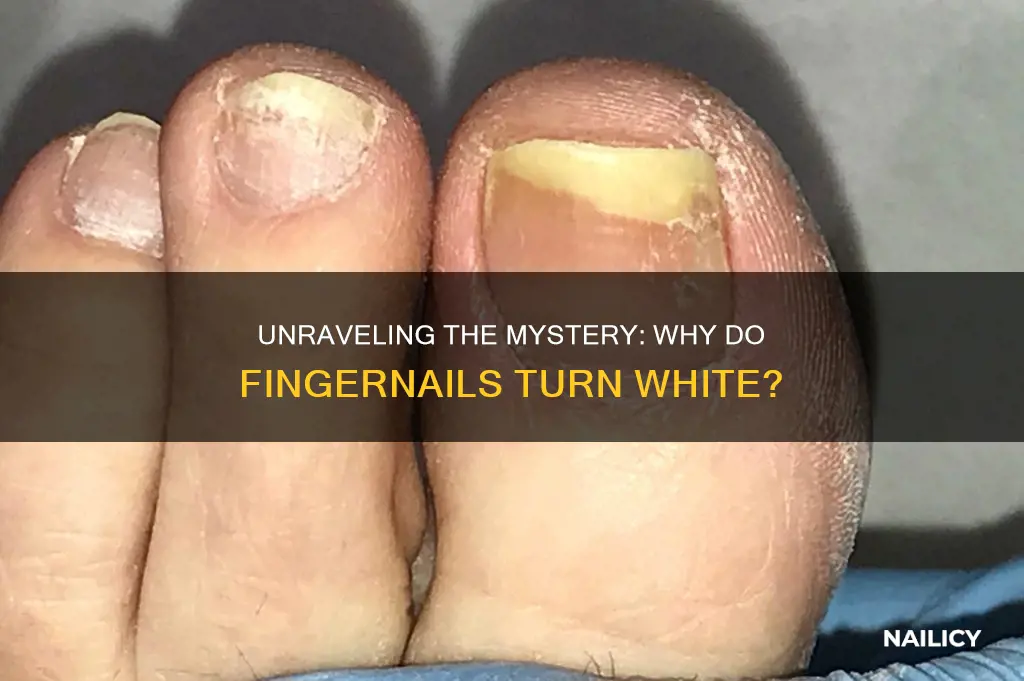 why do finger nails change to white