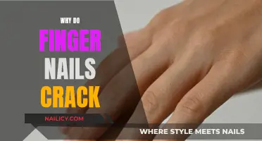 The Mystery of Cracking Fingernails: Causes and Solutions