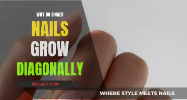 The Mystery of Diagonal Nail Growth Explained