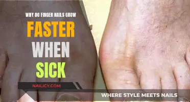 Faster Fingernail Growth: A Sign of Sickness?