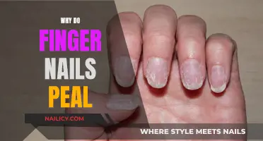 Unraveling the Mystery: Why Do Fingernails Peel?