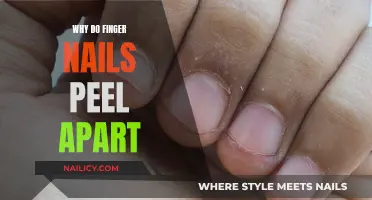 Unraveling the Mystery: Why Do Finger Nails Peel Apart?