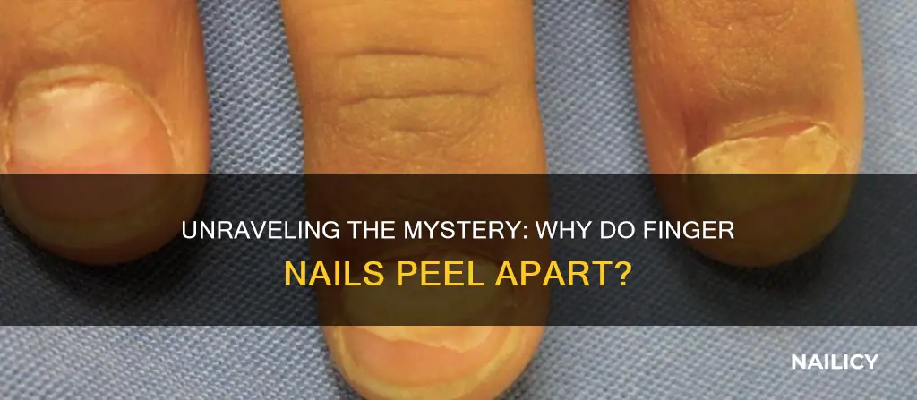 why do finger nails peel apart