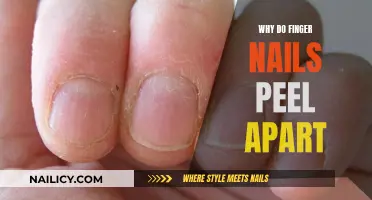 Understanding Peeling Fingernails: Causes and Solutions