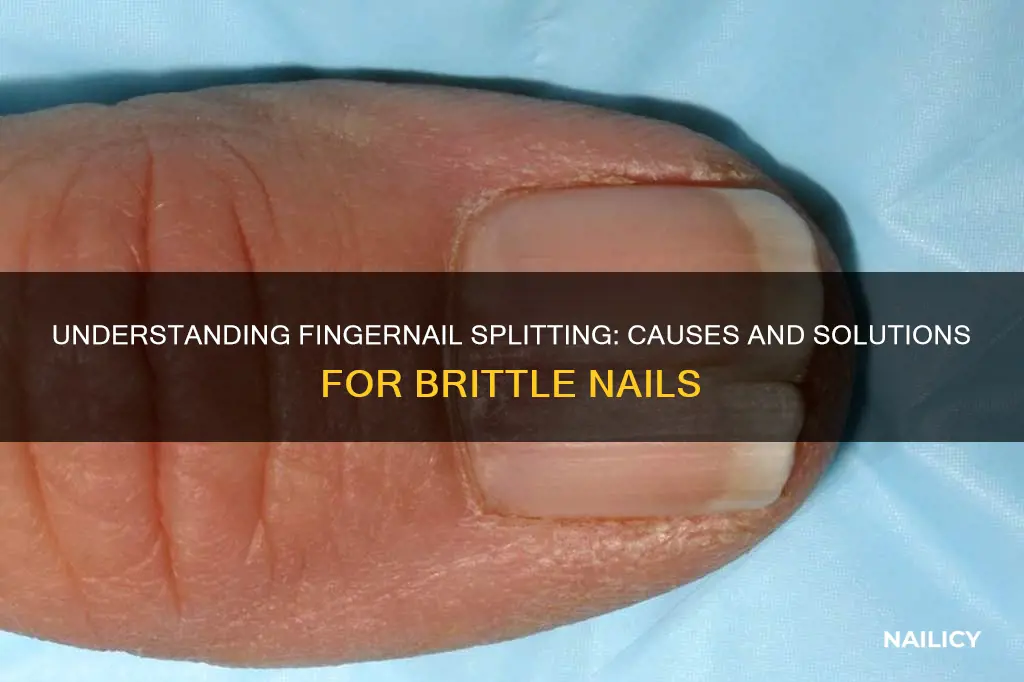 why do finger nails split down the middle