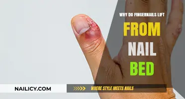 Why Fingernails Lift: Causes, Prevention, and Treatment Explained