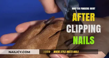 Why Do Fingers Hurt After Clipping Nails? Causes and Remedies
