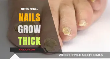 Fungal Nails: Thick Growths and Their Causes