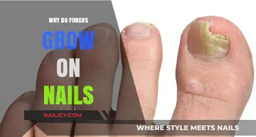 Fungus on Nails: What's the Cause?