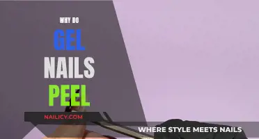 Gel Nails Peeling: Why and How to Prevent It