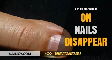 Why Half Moons on Nails Vanish: Causes and Solutions Explained