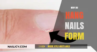 Understanding Hang Nails: Causes, Prevention, and Quick Remedies