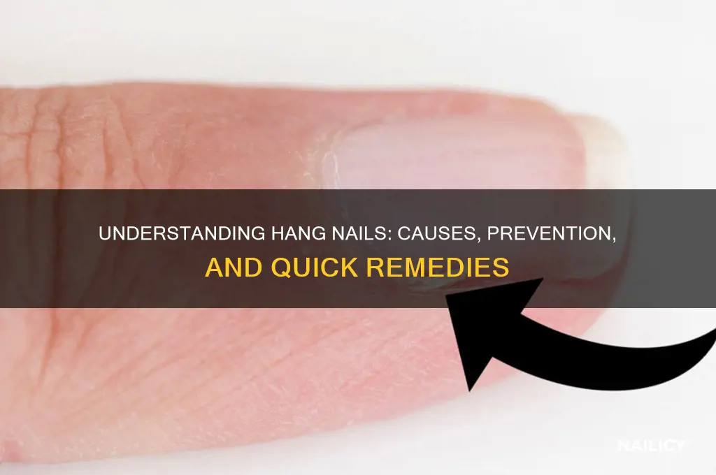 why do hang nails form