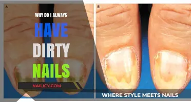 Dirty Nails Dilemma: Understanding Why Your Nails Always Look Unclean