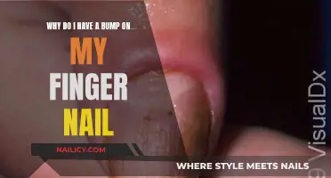 Bump on Your Nail? Here's Why It Appears