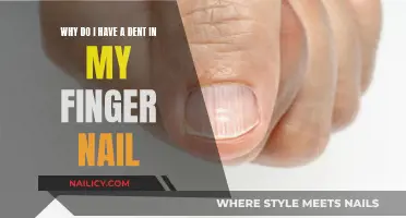 Nail Mystery: Uncovering the Cause of Your Finger Dent