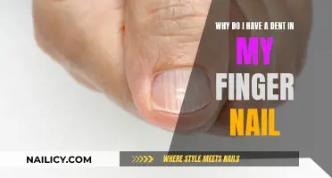 What's Causing the Dent in My Fingernail?