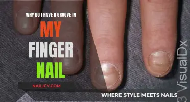 Nail Groove Mystery: Understanding the Finger Nail's Unique Mark