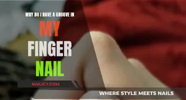 The Mystery of Grooves in Fingernails