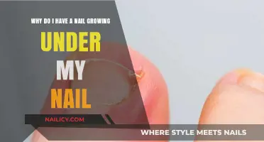 Ingrown Nails: What Causes Them and How to Treat