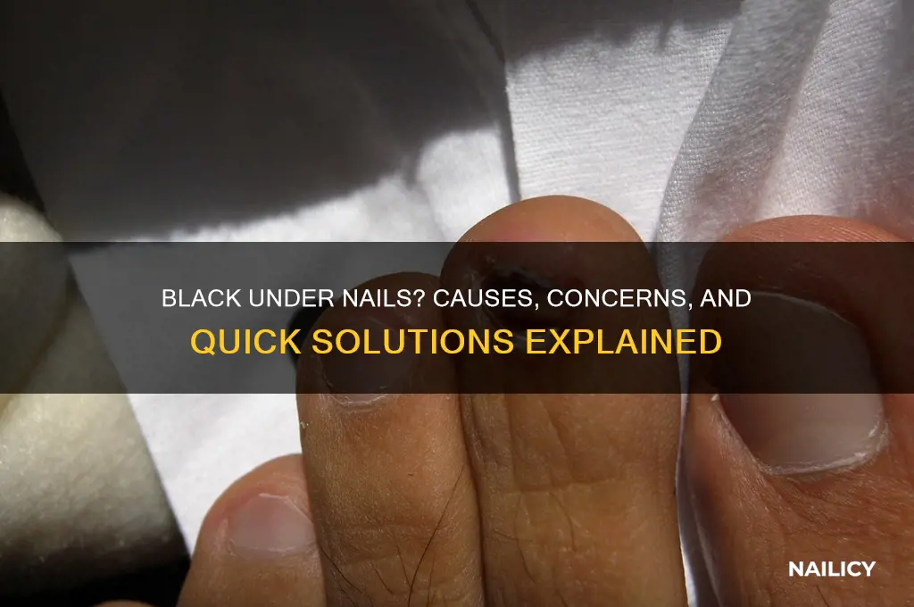 why do i have black under my nails