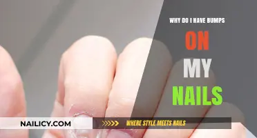 Bumps on Nails: Causes, Concerns, and Effective Solutions Explained