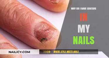Craters in Your Nails? Uncover the Causes and Solutions