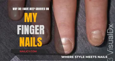 Unraveling the Mystery: Deep Grooves on Your Fingernails Explained