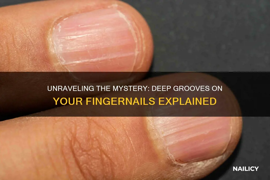 why do i have deep grooves on my finger nails