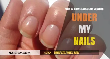 Extra Skin Under Nails: What's the Cause?