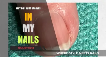 Grooves in Nails: Causes, Concerns, and When to Seek Help