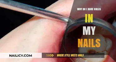 Holes in Your Nails? Causes and Solutions Explained