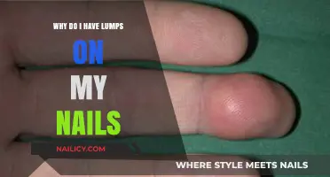 Lumps on Nails: Causes, Concerns, and When to Seek Help