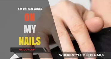 Understanding Lunula: Why Do I Have a White Half-Moon on My Nails?