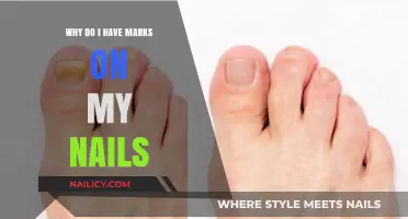 Unveiling the Mystery: Understanding the Causes of Nail Marks