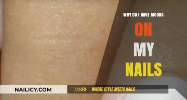 Unveiling the Mystery: Why Do I Have Moons on My Nails?