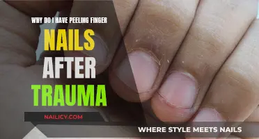 Peeling Nails After an Injury: Understanding the Connection