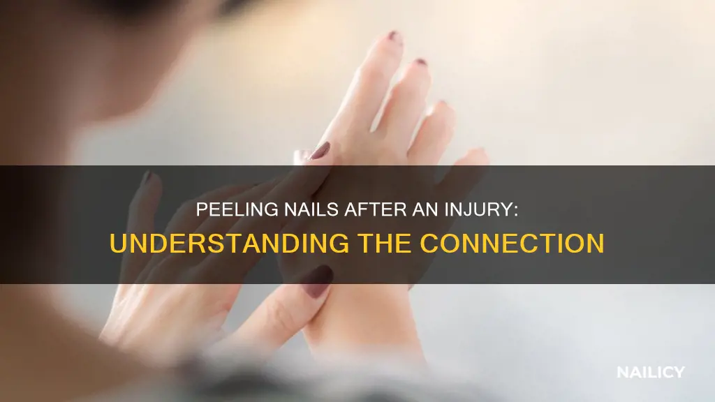 why do i have peeling finger nails after trauma