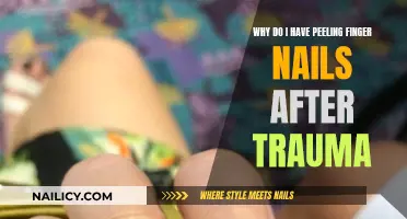 Trauma-Induced Peeling Nails: What Does It Mean?