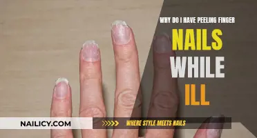 Peeling Nails: Understanding the Connection to Illness