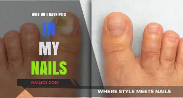 Pits in Nails: Causes, Concerns, and Effective Solutions Explained
