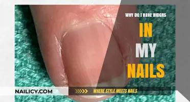 Why Do I Have Ridges in My Nails? Causes and Solutions
