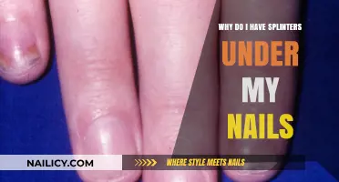 Splinters Under Nails: Causes, Prevention, and Quick Relief Tips
