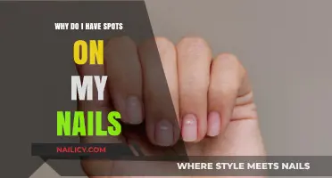 Spots on Nails: Causes, Concerns, and When to Seek Help