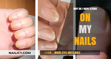 Uncovering the Causes of Unsightly Stains on Your Fingernails