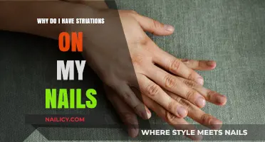 Understanding Nail Striations: Causes, Concerns, and When to Seek Help