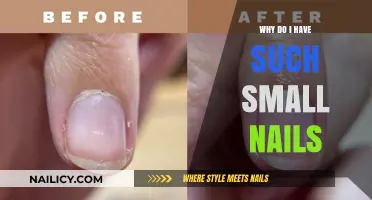 Understanding Small Nails: Causes, Genetics, and Nail Care Tips